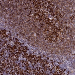 MARCKS like protein Antibody, Novus Biologicals:Antibodies:Primary Antibodies