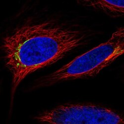 MARCO Antibody, Novus Biologicals:Antibodies:Primary Antibodies
