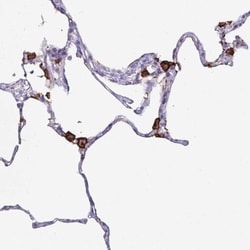 MARCO Antibody, Novus Biologicals:Antibodies:Primary Antibodies
