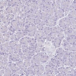 MARCO Antibody, Novus Biologicals:Antibodies:Primary Antibodies