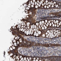 MARK2 Antibody, Novus Biologicals:Antibodies:Primary Antibodies