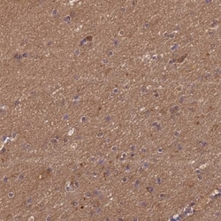 MASA Antibody, Novus Biologicals:Antibodies:Primary Antibodies