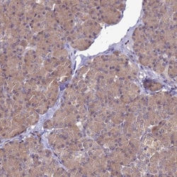 MASA Antibody, Novus Biologicals:Antibodies:Primary Antibodies