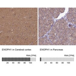 MASA Antibody, Novus Biologicals:Antibodies:Primary Antibodies