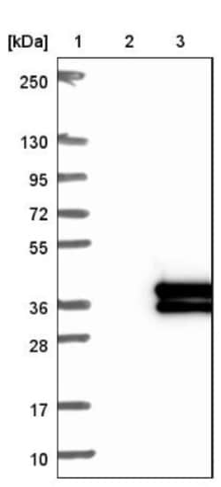 MASA Antibody, Novus Biologicals:Antibodies:Primary Antibodies