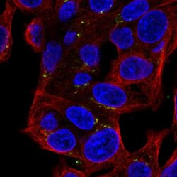 MASP2 Antibody, Novus Biologicals 0.1mL; Unlabeled:Antibodies, Polyclonal