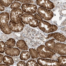 MAST3 Antibody, Novus Biologicals 25 &mu;L; Unlabeled:Antibodies, Polyclonal