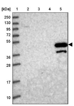 MAT1A Antibody, Novus Biologicals 0.1mL; Unlabeled:Antibodies, Polyclonal