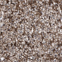MATE1 Antibody, Novus Biologicals 0.1mL; Unlabeled:Antibodies, Polyclonal