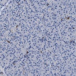 MATE1 Antibody, Novus Biologicals 0.1mL; Unlabeled:Antibodies, Polyclonal