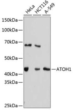 MATH1 Rabbit anti-Human, Clone: 7N3G2, Novus Biologicals 100 &mu;g | Buy Online | Novus Biologicals | Fisher Scientific