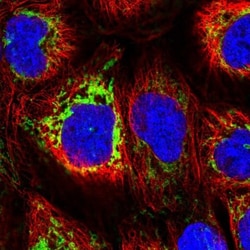 MAVS Antibody, Novus Biologicals 0.1mL; Unlabeled:Antibodies, Polyclonal