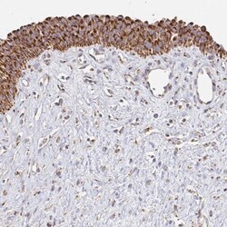 MAVS Antibody, Novus Biologicals 0.1mL; Unlabeled:Antibodies, Polyclonal