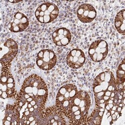 MAVS Antibody, Novus Biologicals 0.1mL; Unlabeled:Antibodies, Polyclonal