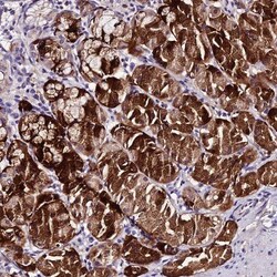 MB21D2 Antibody, Novus Biologicals 25 &mu;L, Unconjugated:Antibodies, Polyclonal