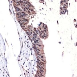 MBD3 Rabbit anti-Human, Mouse, Rat, Clone: 9X1J7, Novus Biologicals:Antibodies:Primary