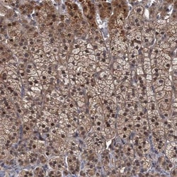 MBD6 Antibody, Novus Biologicals 0.1mL; Unlabeled:Antibodies, Polyclonal