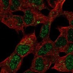 MBLAC2 Rabbit anti-Human, Polyclonal, Novus Biologicals 100 μg; Unconjugated:Antibodies,
