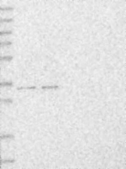 MBLAC2 Rabbit anti-Human, Polyclonal, Novus Biologicals 100 μg; Unconjugated:Antibodies,