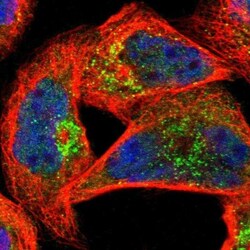 MBNL3 Antibody, Novus Biologicals 0.1mL; Unlabeled:Antibodies, Polyclonal