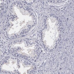 MBNL3 Antibody, Novus Biologicals 0.1mL; Unlabeled:Antibodies, Polyclonal