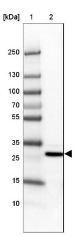 MBNL3 Antibody, Novus Biologicals 0.1mL; Unlabeled:Antibodies, Polyclonal