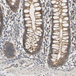 MBTPS2 Antibody, Novus Biologicals:Antibodies:Primary Antibodies