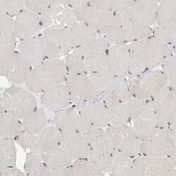 MCAF1 Antibody, Novus Biologicals 0.1mL; Unlabeled:Antibodies, Polyclonal