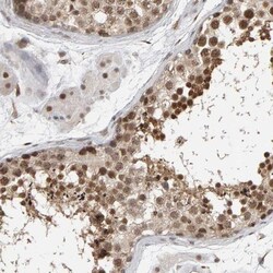 MCAF1 Antibody, Novus Biologicals 0.1mL; Unlabeled:Antibodies, Polyclonal