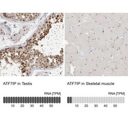 MCAF1 Antibody, Novus Biologicals 0.1mL; Unlabeled:Antibodies, Polyclonal