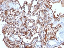 MCAM/CD146 Antibody (MCAM/1101), Novus Biologicals 0.2mg; Unlabeled:Antibodies,