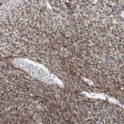 MCC Antibody, Novus Biologicals:Antibodies:Primary Antibodies