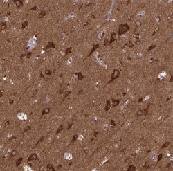 MCCC1 Antibody, Novus Biologicals 25 &mu;L; Unlabeled:Antibodies, Polyclonal