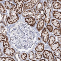 MCCC2 Antibody, Novus Biologicals 0.1mL; Unlabeled:Antibodies, Polyclonal