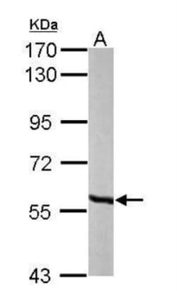 MCCC2 Antibody, Novus Biologicals 100 ul; Unconjugated:Antibodies, Polyclonal