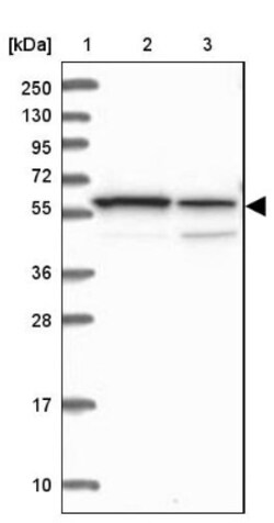 MCCC2 Antibody, Novus Biologicals 0.1mL; Unlabeled:Antibodies, Polyclonal