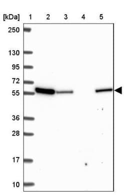 MCCC2 Antibody, Novus Biologicals 25 &mu;L, Unlabeled:Antibodies, Polyclonal