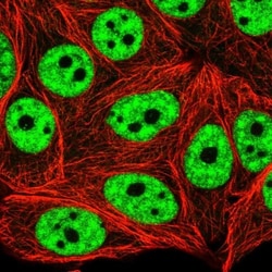 MCM2 Antibody, Novus Biologicals 0.1mL; Unlabeled:Antibodies, Polyclonal