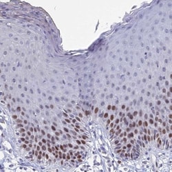 MCM2 Antibody, Novus Biologicals 0.1mL; Unlabeled:Antibodies, Polyclonal
