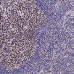 MCM2 Antibody, Novus Biologicals 0.1mL; Unlabeled:Antibodies, Polyclonal