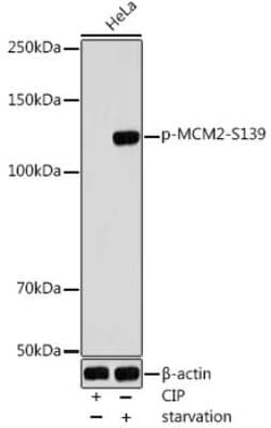 MCM2 Rabbit anti-Human, Polyclonal, Novus Biologicals 100 &mu;g; Unconjugated:Antibodies,