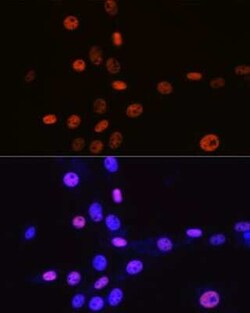 MCM3 Rabbit anti-Human, Mouse, Rat, Clone: 9Z5W4, Novus Biologicals 100 &mu;g | Buy Online | Novus Biologicals | Fisher Scientific