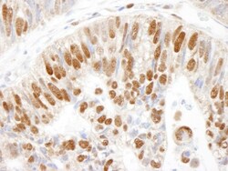 MCM3 Antibody, Novus Biologicals 0.1mL; Unlabeled:Antibodies, Polyclonal
