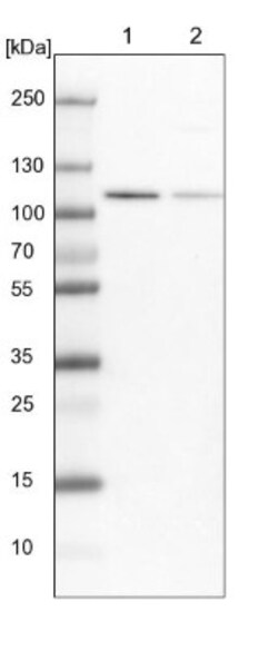MCM3 Antibody, Novus Biologicals 0.1mL; Unlabeled:Antibodies, Polyclonal