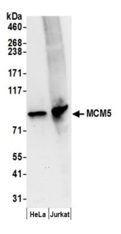 MCM5 Antibody, Novus Biologicals 0.1mL; Unlabeled:Antibodies, Polyclonal