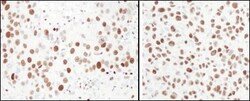 MCM6 Antibody, Novus Biologicals 0.1mg; Unlabeled:Antibodies, Polyclonal