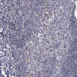 MCMBP Antibody, Novus Biologicals 25 &mu;L | Buy Online | Novus Biologicals | Fisher Scientific