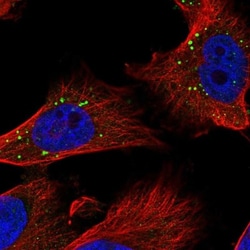 MCPIP1/ZC3H12A Antibody, Novus Biologicals 0.1mL; Unlabeled:Antibodies,
