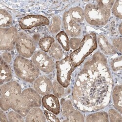 MCPIP1/ZC3H12A Antibody, Novus Biologicals 0.1mL; Unlabeled:Antibodies,