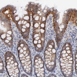 MCT1/SLC16A1 Antibody, Novus Biologicals:Antibodies:Primary Antibodies